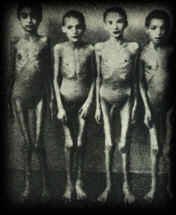Holocaust Children Skeletons Emaciated